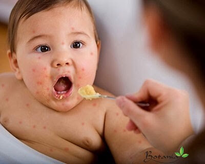 Chế độ dinh dưỡng dành cho trẻ khi bị chân tay miệng