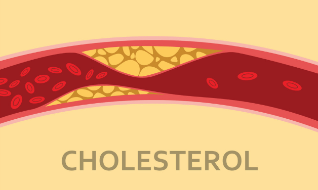 Tìm hiểu về cholesterol máu