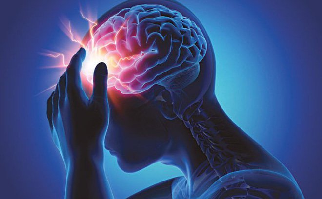 6 Nguyên tắc cơ bản trong điều trị tai biến mạch máu não