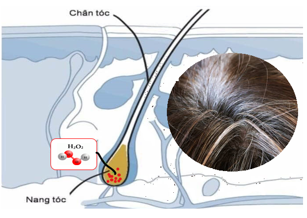H2O2- Thủ phạm gây ra tình trạng tóc bạc sớm