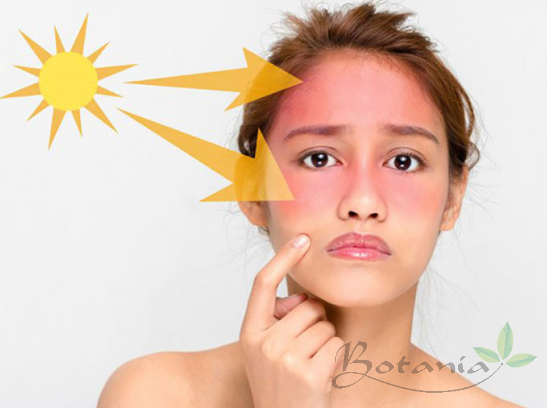  Xịt khoáng giúp làm dịu da khi da bị kích ứng và tổn thương trước ánh nắng mặt trời