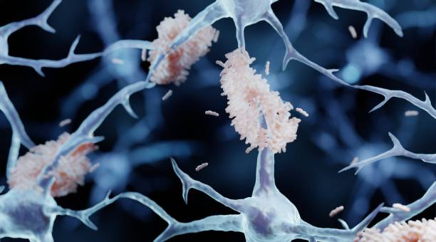 Các amyloid beta tích tụ tại synap